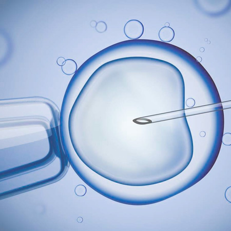 Fecundación in vitro reproducción asistida Murcia
                        