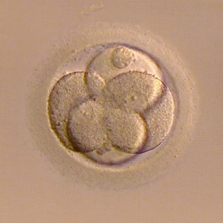 Fecundación in vitro reproducción asistida Murcia
                        
